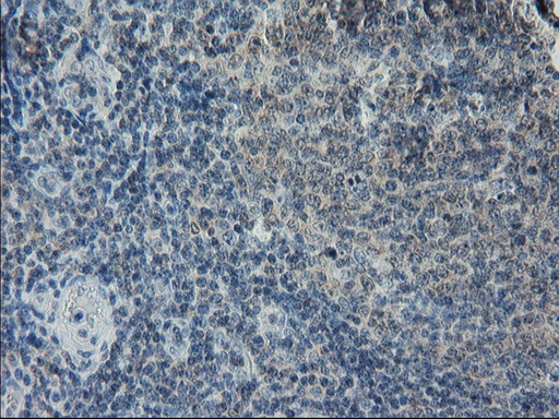 LGR5 Antibody in Immunohistochemistry (Paraffin) (IHC (P))