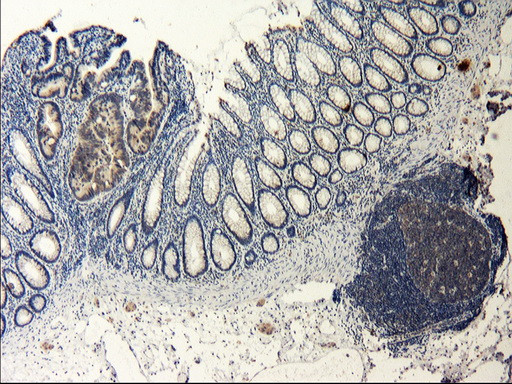 LGR5 Antibody in Immunohistochemistry (Paraffin) (IHC (P))