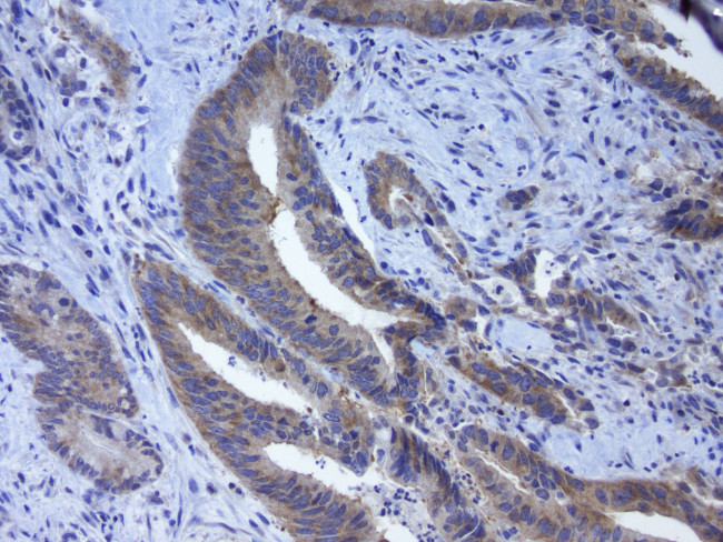 LGR5 Antibody in Immunohistochemistry (Paraffin) (IHC (P))