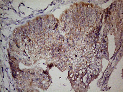 LGR5 Antibody in Immunohistochemistry (Paraffin) (IHC (P))