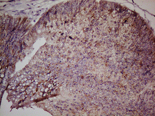 LGR5 Antibody in Immunohistochemistry (Paraffin) (IHC (P))