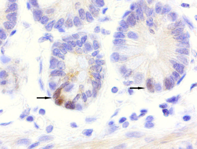 LGR5 Antibody in Immunohistochemistry (Paraffin) (IHC (P))