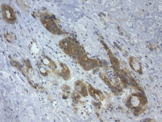 LGR5 Antibody in Immunohistochemistry (Paraffin) (IHC (P))