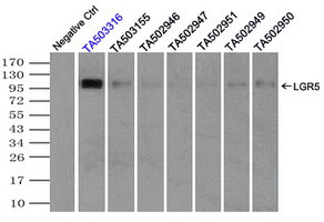 LGR5 Antibody in Immunoprecipitation (IP)