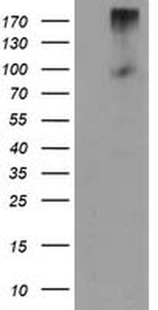 LGR5 Antibody in Western Blot (WB)