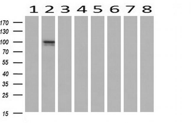 LGR6 Antibody in Western Blot (WB)