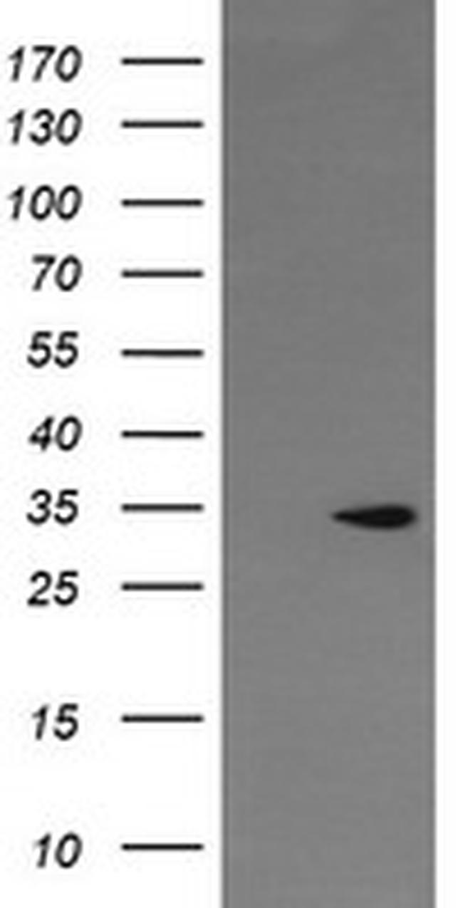 LGR6 Antibody in Western Blot (WB)