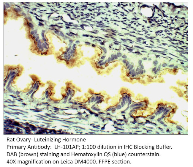 Luteinizing Hormone Antibody in Immunohistochemistry (IHC)