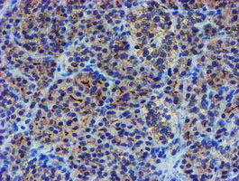 LHX1 Antibody in Immunohistochemistry (Paraffin) (IHC (P))