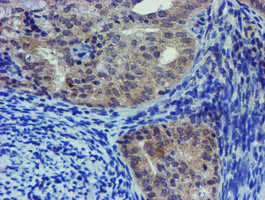 LHX1 Antibody in Immunohistochemistry (Paraffin) (IHC (P))