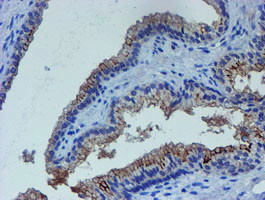 LHX1 Antibody in Immunohistochemistry (Paraffin) (IHC (P))