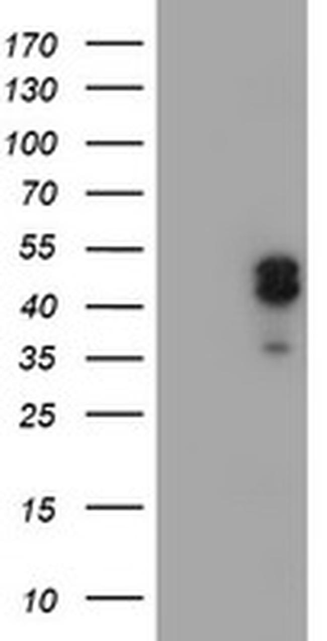 LHX1 Antibody in Western Blot (WB)