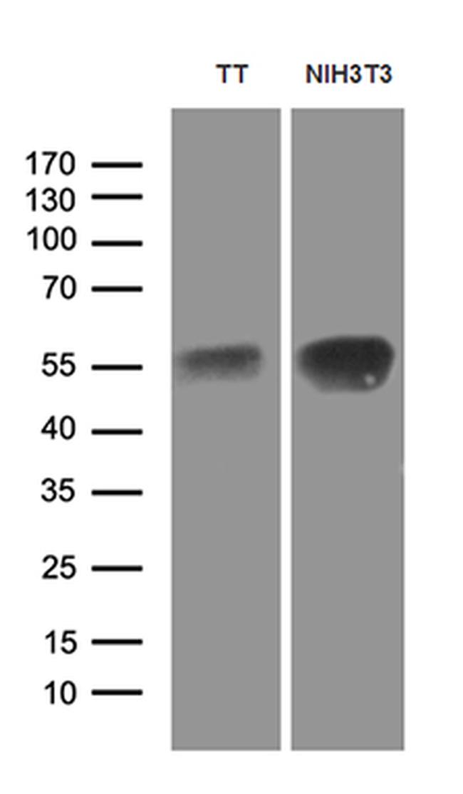 LHX2 Antibody in Western Blot (WB)