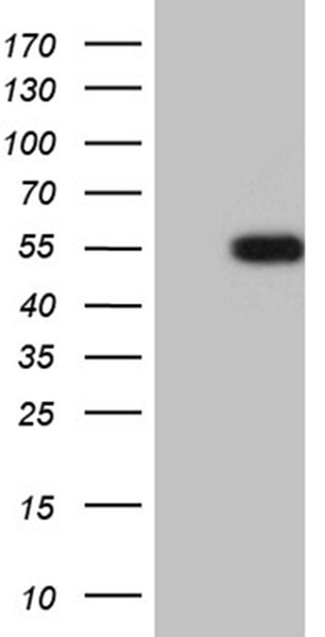 LHX2 Antibody in Western Blot (WB)