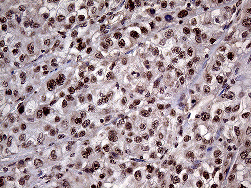 LHX4 Antibody in Immunohistochemistry (Paraffin) (IHC (P))