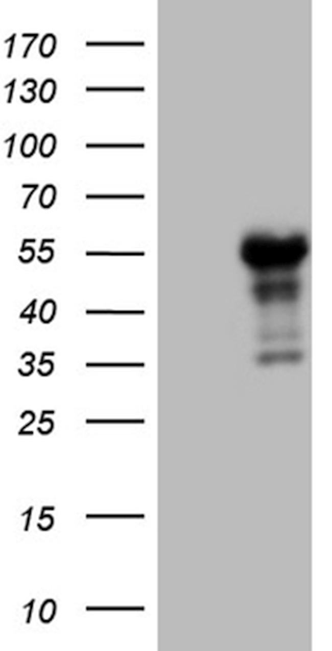 LHX4 Antibody in Western Blot (WB)