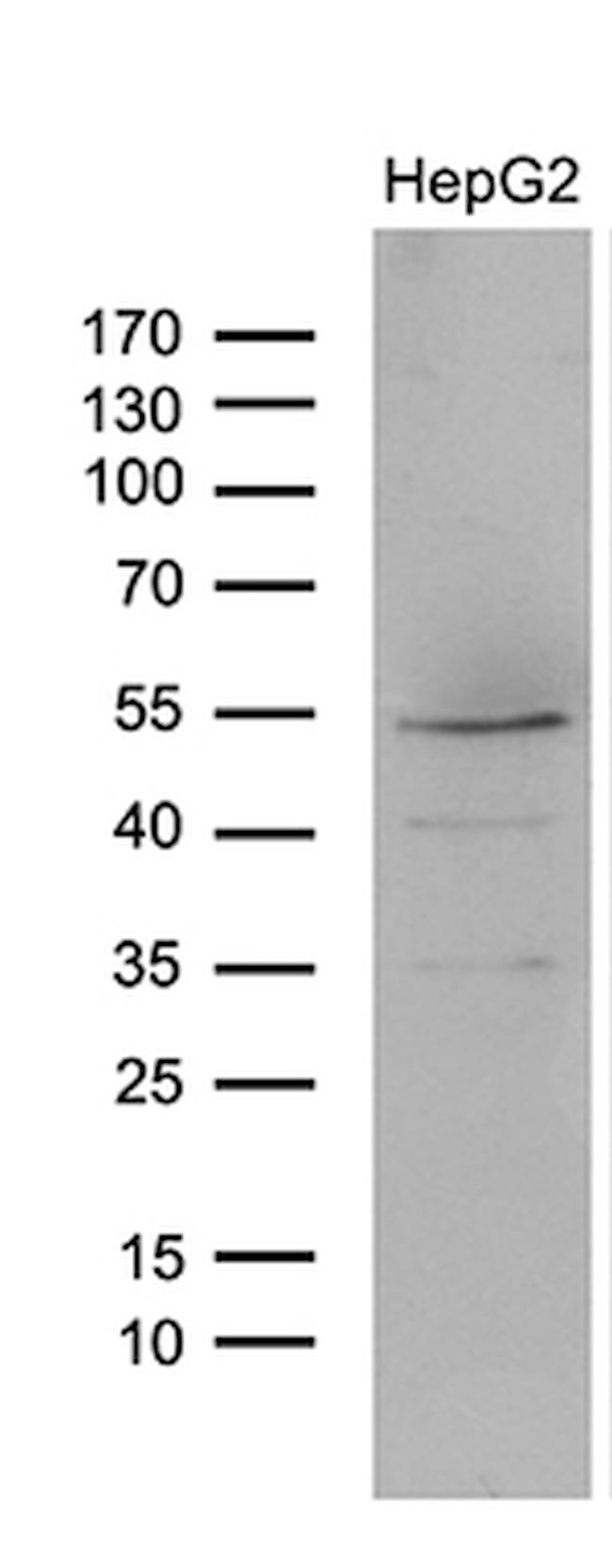 LHX4 Antibody in Western Blot (WB)