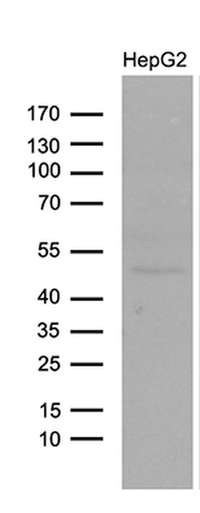 LHX4 Antibody in Western Blot (WB)