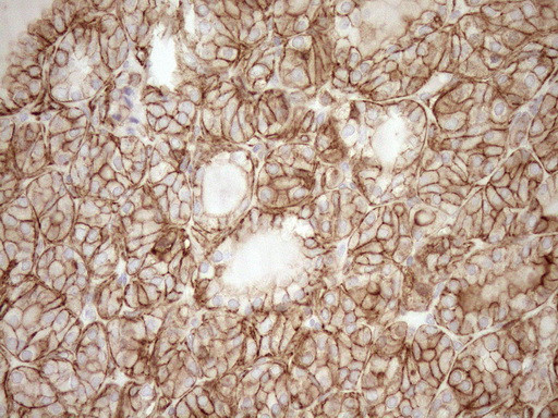 LIMA1 Antibody in Immunohistochemistry (Paraffin) (IHC (P))