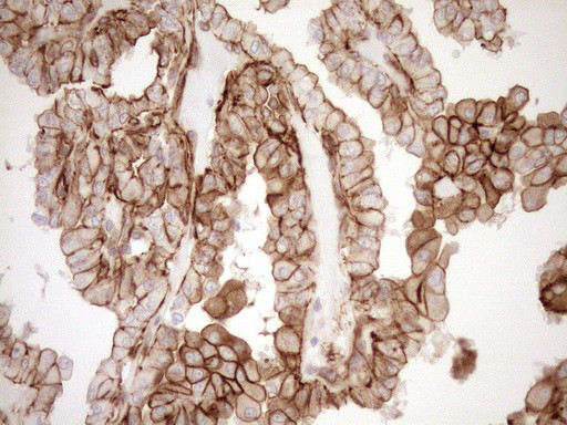 LIMA1 Antibody in Immunohistochemistry (Paraffin) (IHC (P))