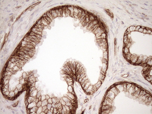 LIMA1 Antibody in Immunohistochemistry (Paraffin) (IHC (P))