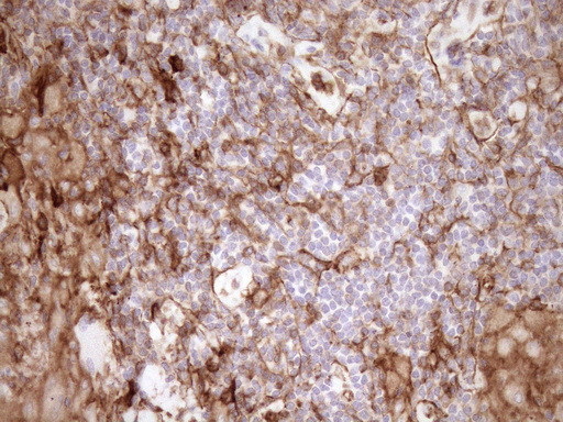 LIMA1 Antibody in Immunohistochemistry (Paraffin) (IHC (P))