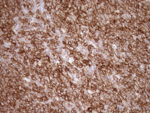 LIMA1 Antibody in Immunohistochemistry (Paraffin) (IHC (P))