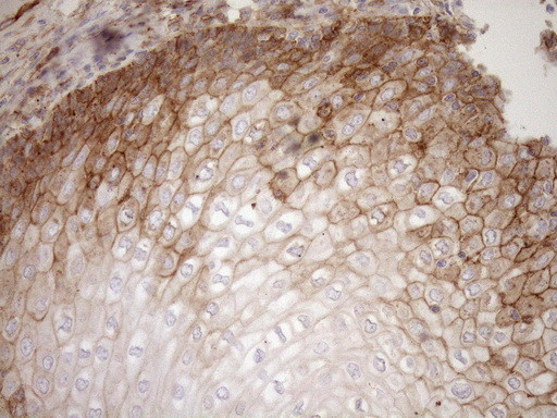 LIMA1 Antibody in Immunohistochemistry (Paraffin) (IHC (P))