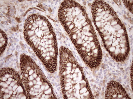 LIMA1 Antibody in Immunohistochemistry (Paraffin) (IHC (P))