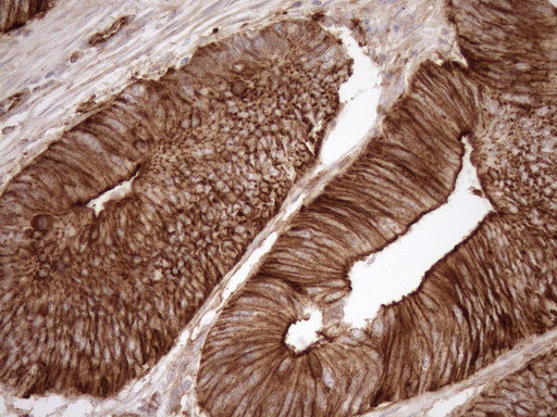 LIMA1 Antibody in Immunohistochemistry (Paraffin) (IHC (P))