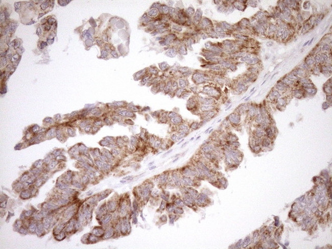 LIMA1 Antibody in Immunohistochemistry (Paraffin) (IHC (P))