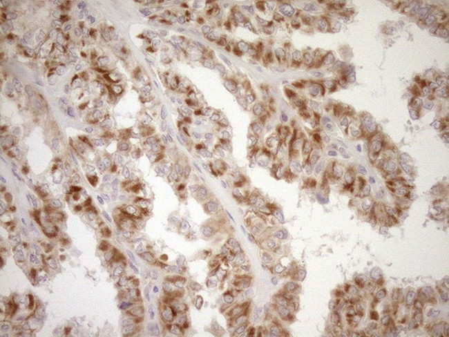 LIMA1 Antibody in Immunohistochemistry (Paraffin) (IHC (P))