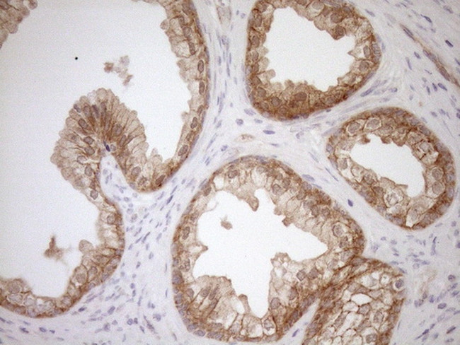 LIMA1 Antibody in Immunohistochemistry (Paraffin) (IHC (P))