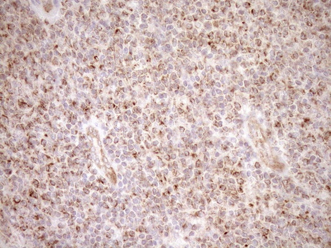 LIMA1 Antibody in Immunohistochemistry (Paraffin) (IHC (P))