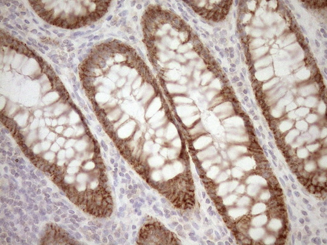 LIMA1 Antibody in Immunohistochemistry (Paraffin) (IHC (P))