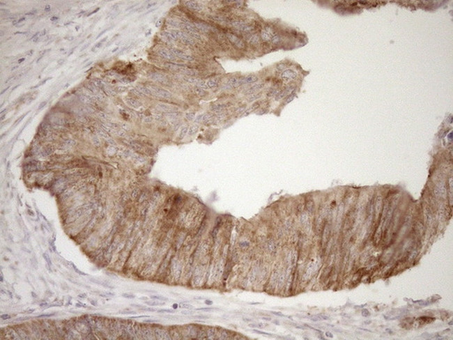 LIMA1 Antibody in Immunohistochemistry (Paraffin) (IHC (P))