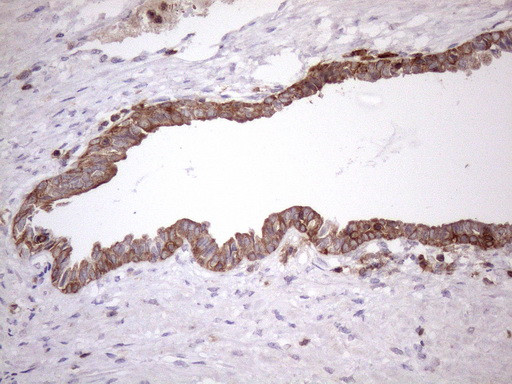 LIME1 Antibody in Immunohistochemistry (Paraffin) (IHC (P))