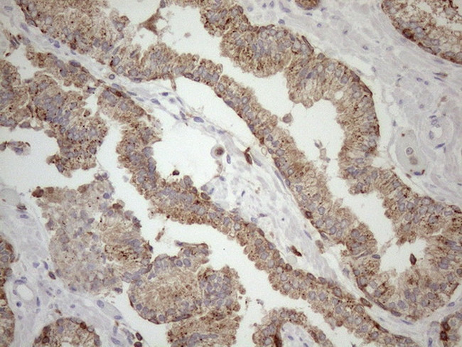 LIME1 Antibody in Immunohistochemistry (Paraffin) (IHC (P))