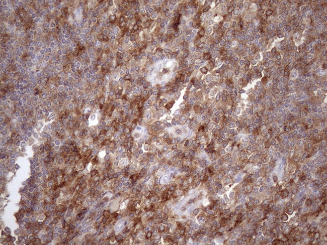 LIME1 Antibody in Immunohistochemistry (Paraffin) (IHC (P))