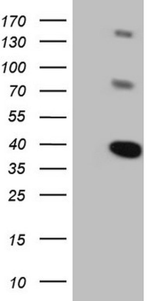 LIME1 Antibody in Western Blot (WB)