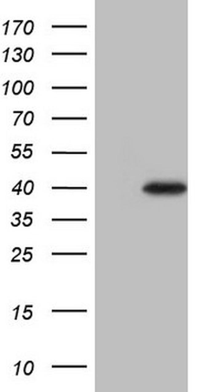 LIME1 Antibody in Western Blot (WB)