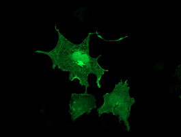 LIMK1 Antibody in Immunocytochemistry (ICC/IF)