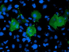 LIMK1 Antibody in Immunocytochemistry (ICC/IF)