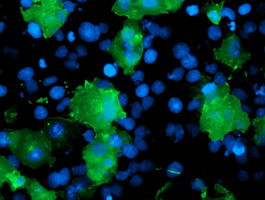 LIMK1 Antibody in Immunocytochemistry (ICC/IF)