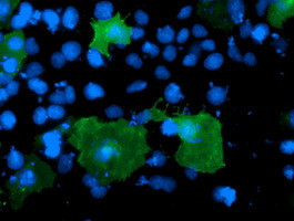 LIMK1 Antibody in Immunocytochemistry (ICC/IF)