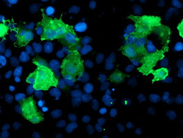 LIMK1 Antibody in Immunocytochemistry (ICC/IF)