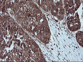 LIMK1 Antibody in Immunohistochemistry (Paraffin) (IHC (P))