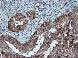 LIMK1 Antibody in Immunohistochemistry (Paraffin) (IHC (P))