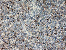 LIMK1 Antibody in Immunohistochemistry (Paraffin) (IHC (P))