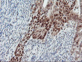 LIMK1 Antibody in Immunohistochemistry (Paraffin) (IHC (P))